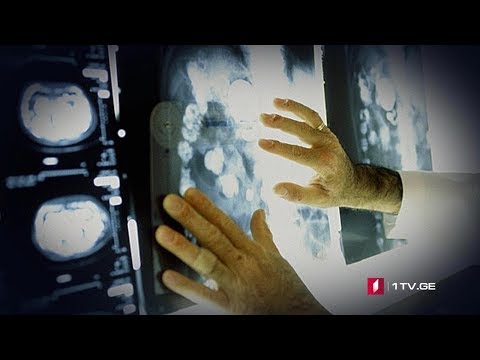 ონკოლოგიური პაციენტების მკურნალობის დაფინანსება