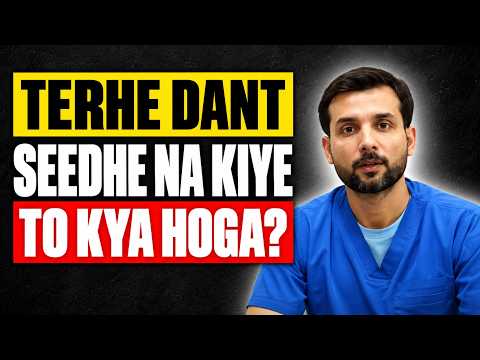 Dant Seedhe Karne Ka Tarika - Teeth Alignment Benefits & Treatment - Teerhe Danton Ka Ilaj thumbnail image