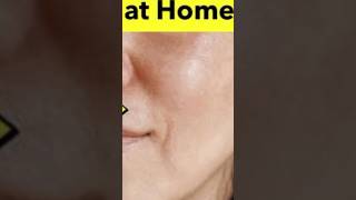 ALL SKIN PROBLEMS,                   ONE SOLUTION #trending #viral #shortsfeed #youtube #skincare