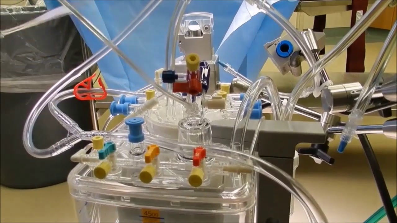 Cardopulmonary Bypass Setup