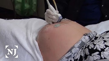 Unnecessary C-sections decreased in New Jersey