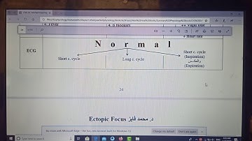 Mind Maps Physiology (ECG Arrhythmia), New system, Dr Mohamed Fayez