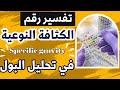 14 ما هي الكثافة النوعية للبول Specific Gravity وكيفية تفسير حالات ارتفاع وانخفاض نسبتها 