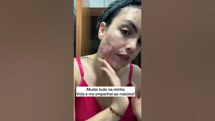 LUTA CONTRA ACNE NÃO É FÁCIL #shorts