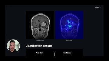 Brain Tumor Classification with Neural Networks | Headstarter Accelerator AI Project 2 Overview