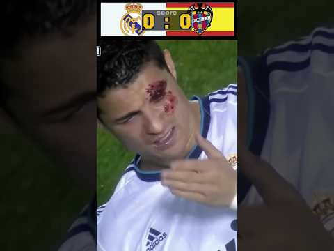 Ronaldo's Eye Damage Real Madrid vs Levante Match Intensity