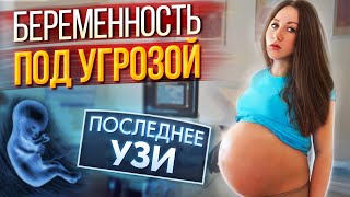 Беременность под Угрозой - Последнее УЗИ  - Я Беременна 37 Недель | Elli Di