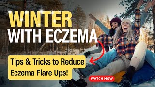 Eczema in the Winter: How to control your flares in the cold