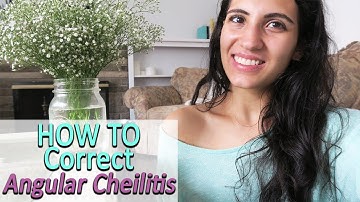 Causes & Remedies for Angular Cheilitis | How to Correct it Fast!