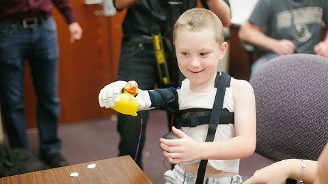 Alex - By the Limbitless Project