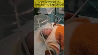 Low Oxygen in Newborns Explained! #neonatologist #newbornbaby #foryou #baby  #cute #fypシ゚viral