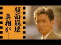 新沼謙治が松居直美と"極秘再婚"の真相...抱える難病に驚きを隠せない...「津軽恋女」で有名な演歌歌手の半年で2度の大怪我で"顔面崩壊"した血まみれ事件がヤバすぎた...