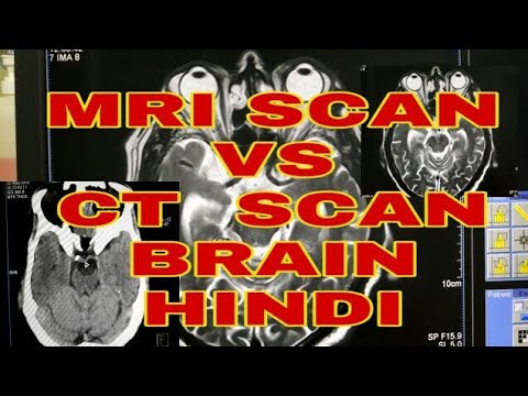 MRI Brain and CT SCAN brain difference in Hindi by | Radiographer ...