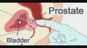 Male G Spot   How To Reach Prostate Orgasm