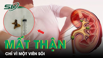 Mất Cả Quả Thận Chỉ Vì Một Viên Sỏi | SKĐS