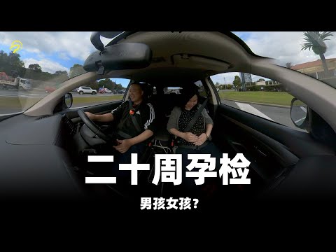 VLOG | 怀孕20周检查，揭晓男孩or女孩？