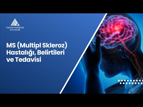Video: MS (Multipl Skleroz) Gelişme Riskinizi Azaltmanın 3 Yolu
