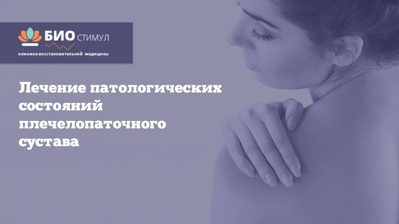 Лечение паталогических состояний плечелопаточного сустава - YouTube
