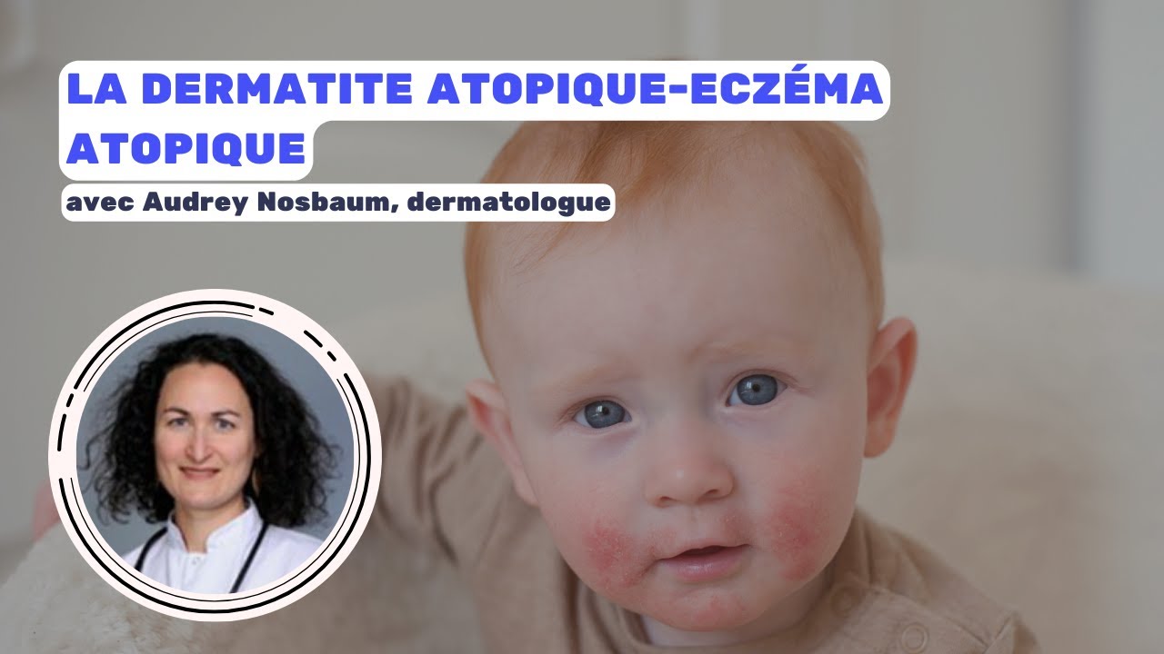 🎯 Dermatite atopique : l’essentiel à connaître