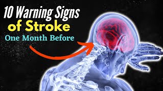 10 Warning Signs of Stroke One Month Before - Unbelievable Signs... Revealed! screenshot 3