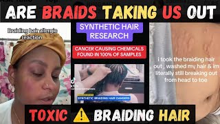 BRAIDING HAIR Making You SICK?! Allergic Reactions & Scary Symptoms | Braids GONE Wrong
