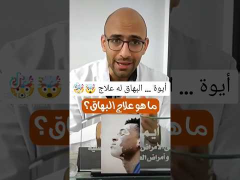 أيوة البهاق له علاج العلاجات الموضعية      