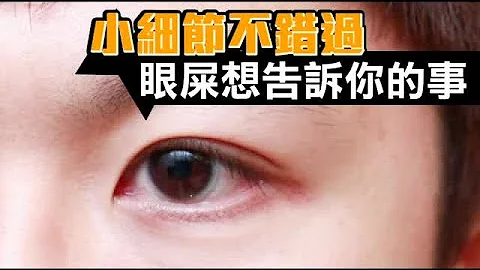 眼屎辨別健康 醫生教你看出端倪 | 台灣蘋果日報 - 天天要聞