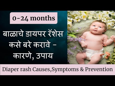 बाळाचे डायपर रॅशेस कसे बरे करावे -कारणे आणि उपाय Diaper rash in babies -Symptoms,Causes & Prevention
