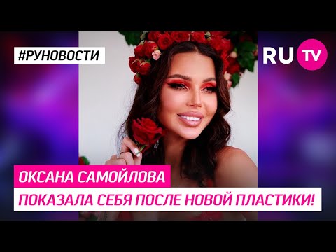 Оксана Самойлова показала себя после новой пластики!