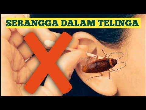 Video: 6 Penggunaan Minyak Mineral: Untuk Kulit, Kaki, Telinga, Sembelit, Dan Banyak Lagi