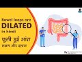 Bowel Loops are Dilated  in Hindi || फूली हुई आंत: लक्षण और इलाज की जानकारी