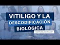 Vitiligo | Ángeles Wolder