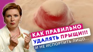 ОСТОРОЖНО ПРЫЩЬ! Как правильно избавиться от прыщей и не навредить себе