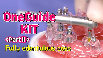 [EASY Hands-on] OneGuide KIT PartⅡ - Fully edentulous case