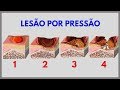 Lesão por pressão