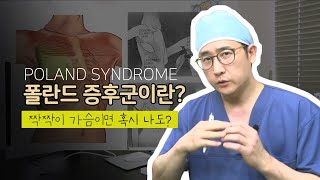폴란드 증후군이란? 짝짝이 가슴인데 혹시 나도 폴란드 증후군?