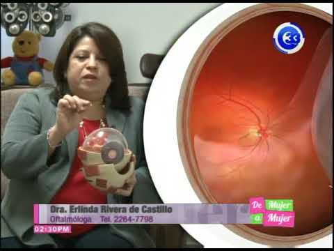 son malas las moscas volantes en los ojos