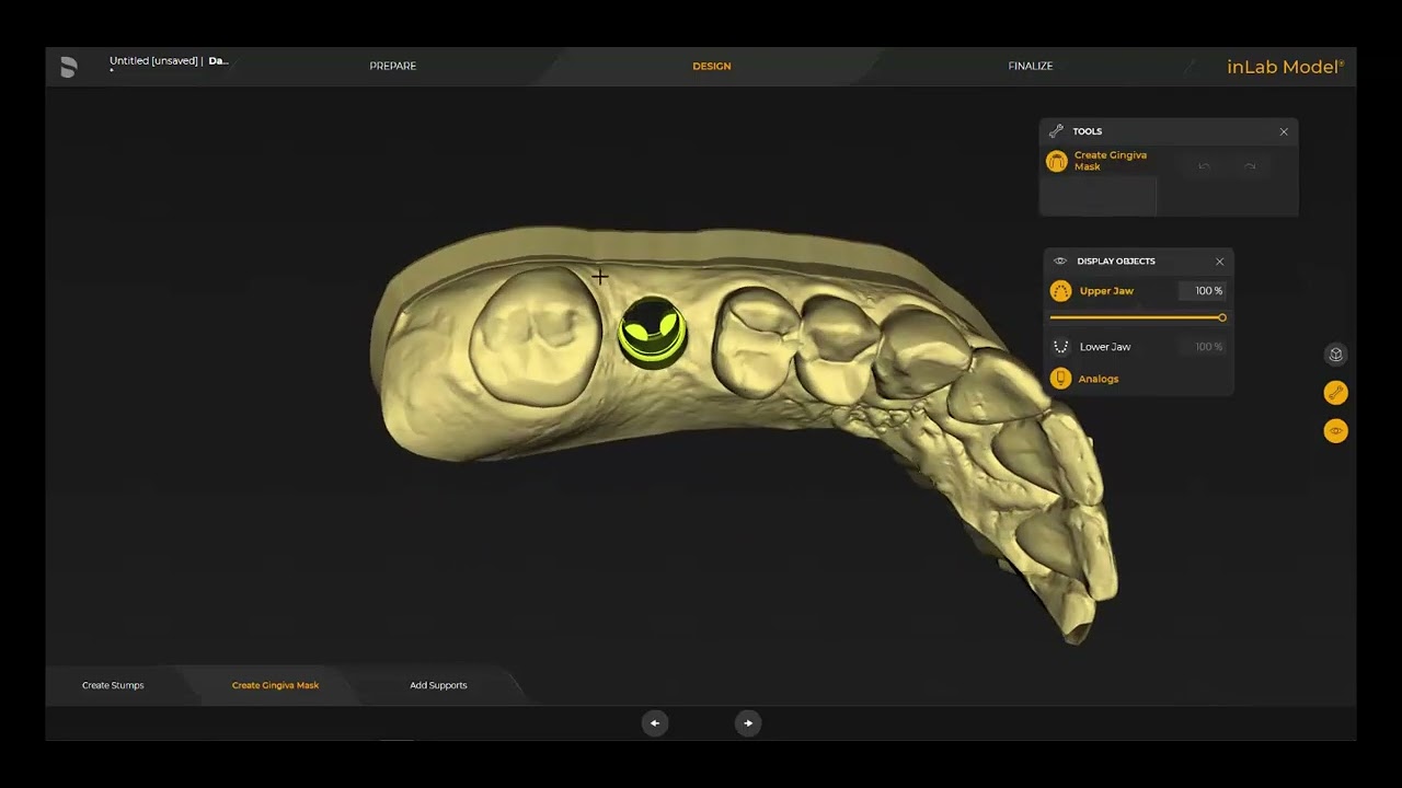 Design of a Gingiva Mask with inLab Software - YouTube