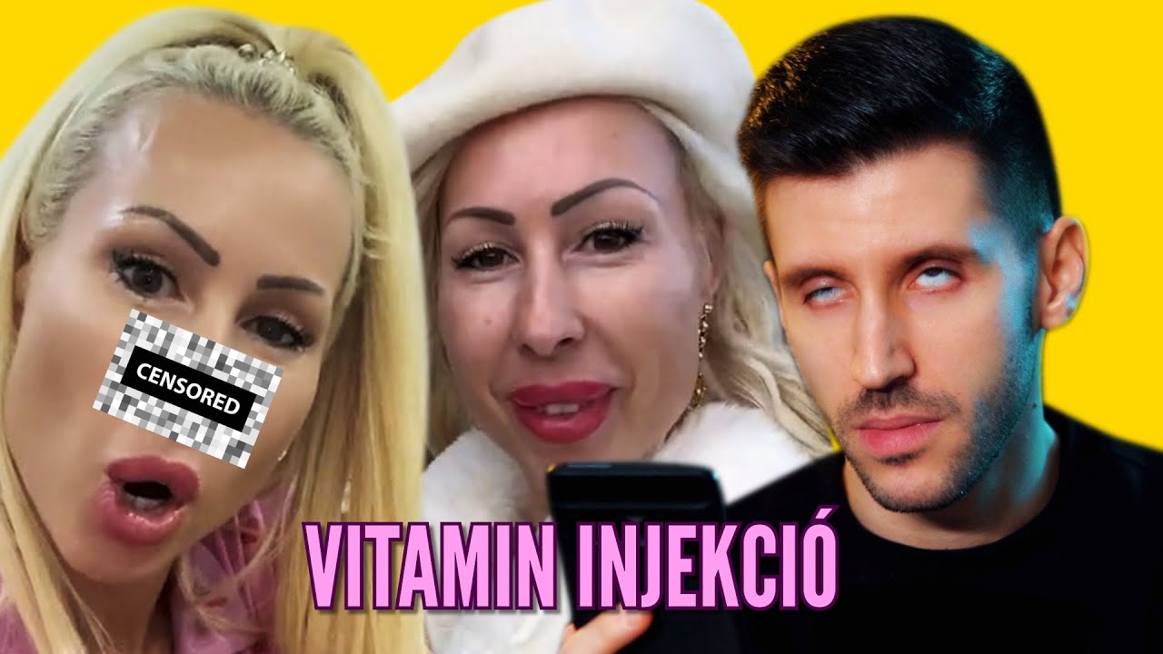 Jól kinevettük az Adát az orrműtétje után! 🦧💉🛍️