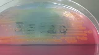 Colony Morphology Of Citrobacter Freundii On Cled Agar