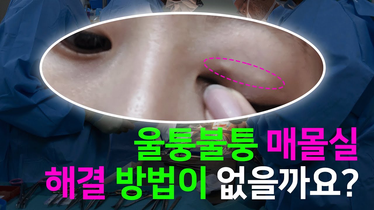 Ганнам Соён гоо сайхны мэс заслын эмнэлэг
Гоо сайхны мэс заслын зөвлөгөө 💌 - Оёдол зангидах аргыг мэдэхгүй ч булсан оёдлыг авах боломжтой юу?