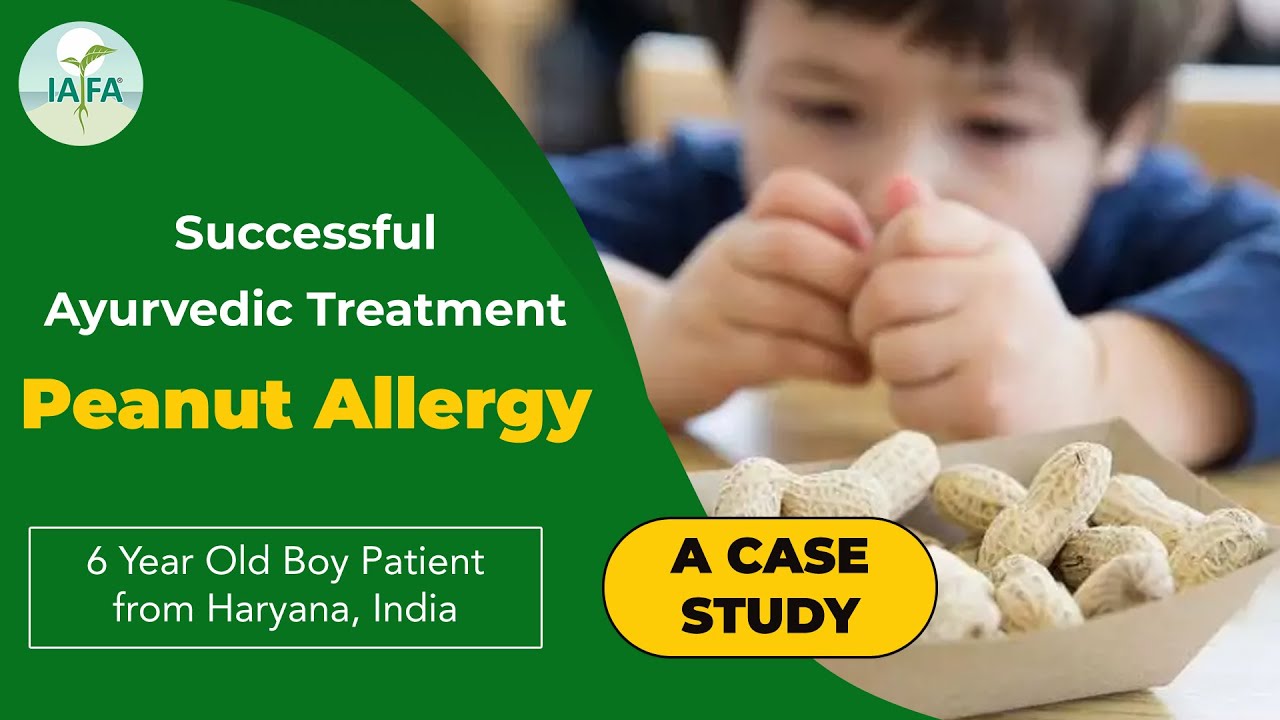 Successful Ayurvedic Treatment Of Peanut Allergy A Case Study YouTube Successful Ayurvedic Treatment Of Peanut Allergy A Case Study YouTube