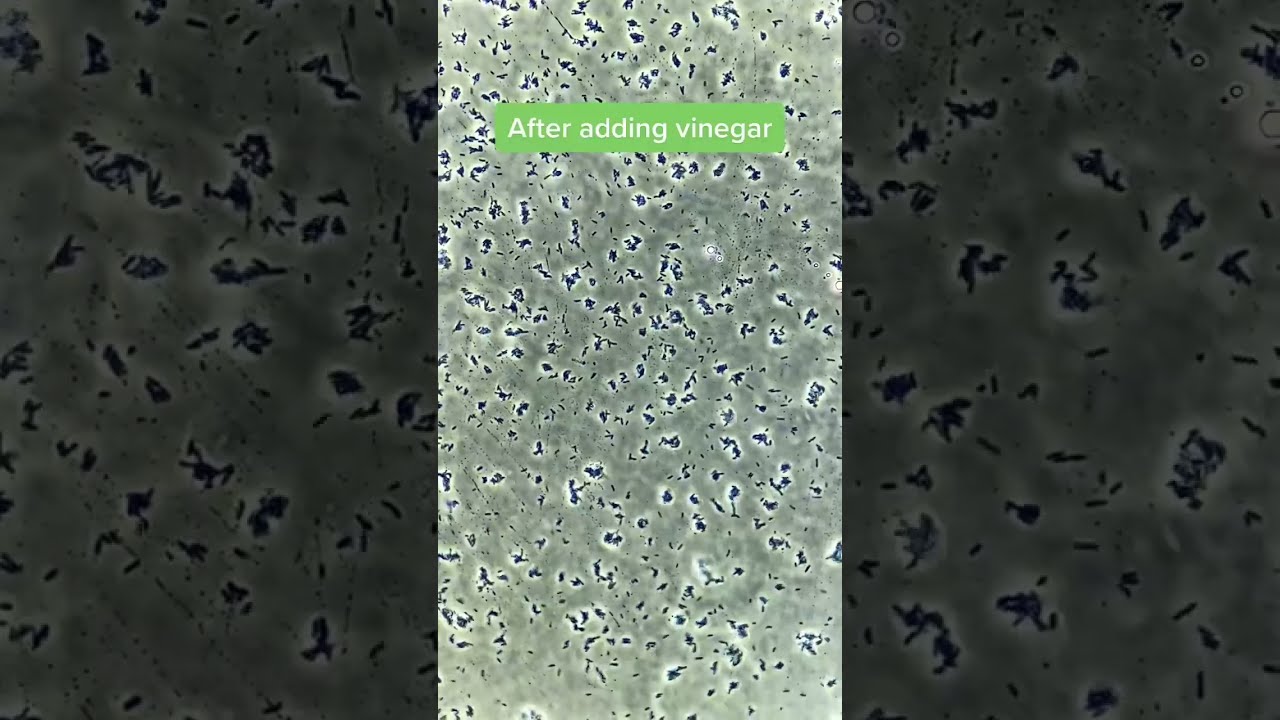 Vinegar VS Bacteria Under The Microscope 