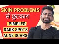 10 आदतें  चेहरे को हमेशा बेदाग़ रखने के लिए - Skin Care Habits Worst to Best | Fit Tuber Hindi