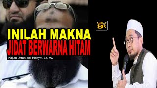 Inilah Makna Tanda Hitam Di Dahi Menurut Ustadz Adi Hidayat