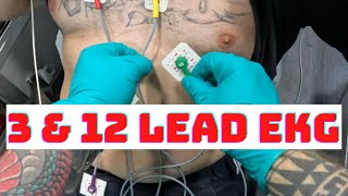 How to acquire 3 and 12 Lead EKG on LifePak 15?
