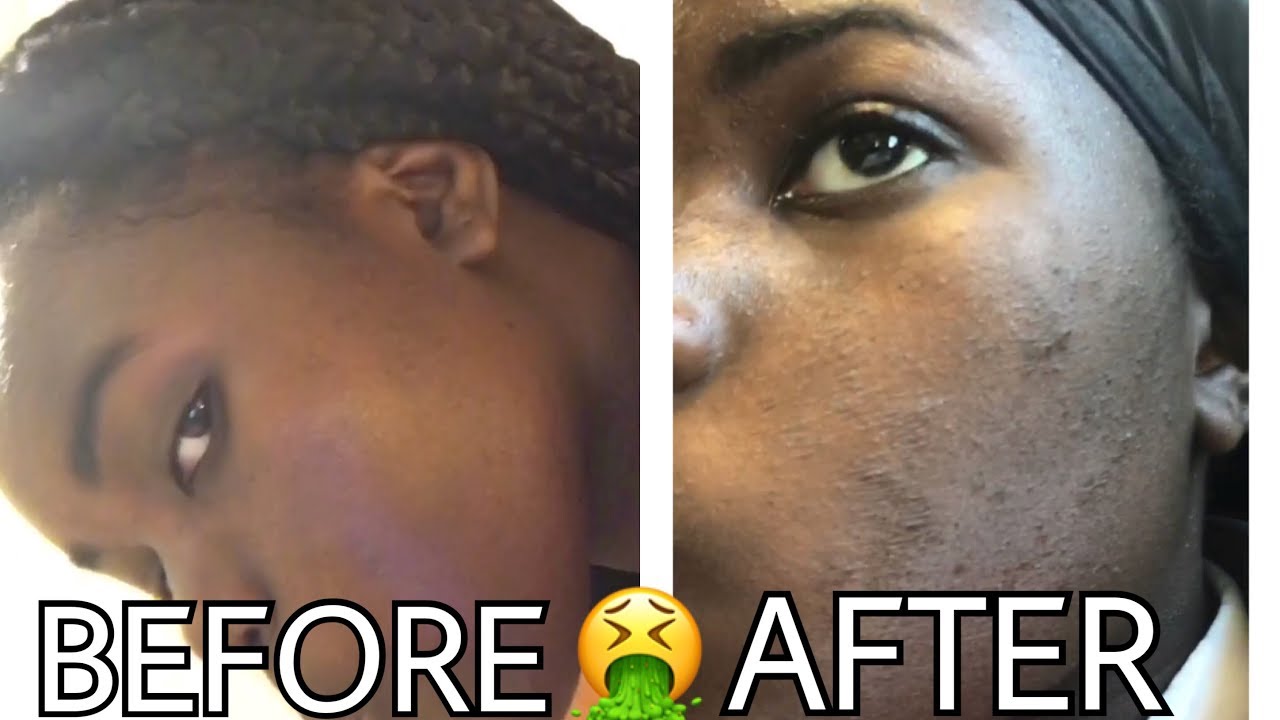 johnson exfoliating daily wash