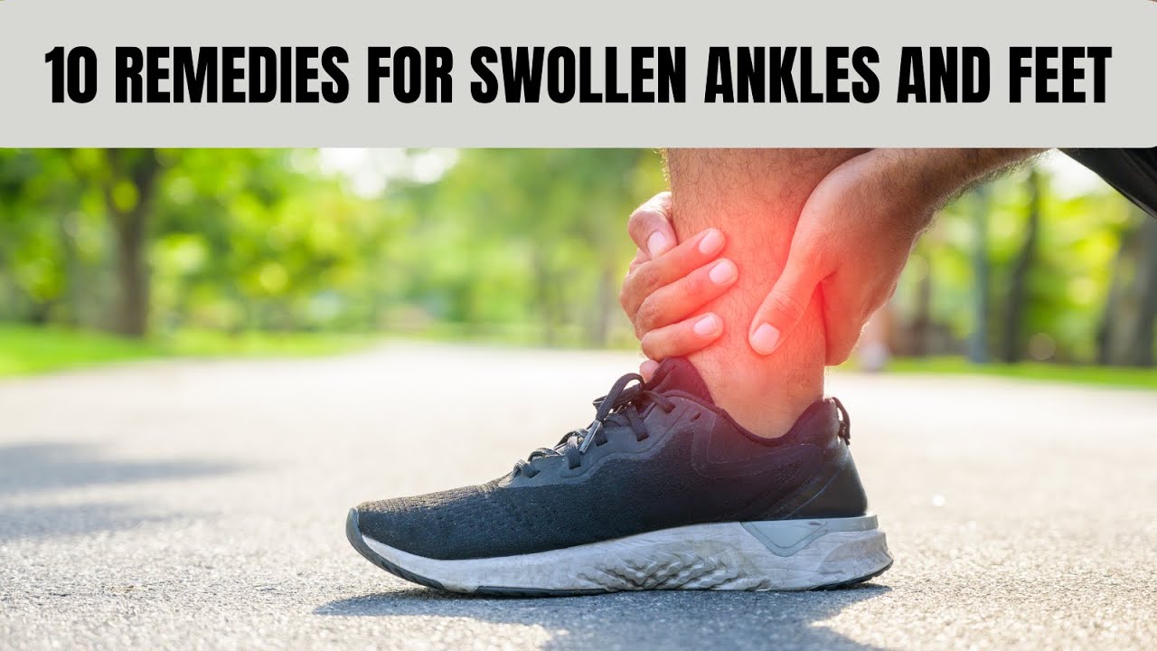 10 INCREDIBLE HOME REMEDIES FOR SWOLLEN ANKLES AND FEET! YouTube