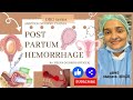 Pph  post partum hemorrhage  introduction  types  causes  management  post partum hemorrhage 
