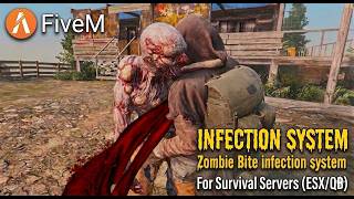 [ESX/QB] JJ Zombie Infection | Grab, Bite &amp; Progressive Infection System 💉🧟